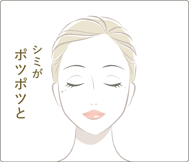 シミがポツポツと