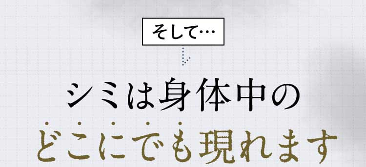 そして…シミは身体中のどこにでも現れます