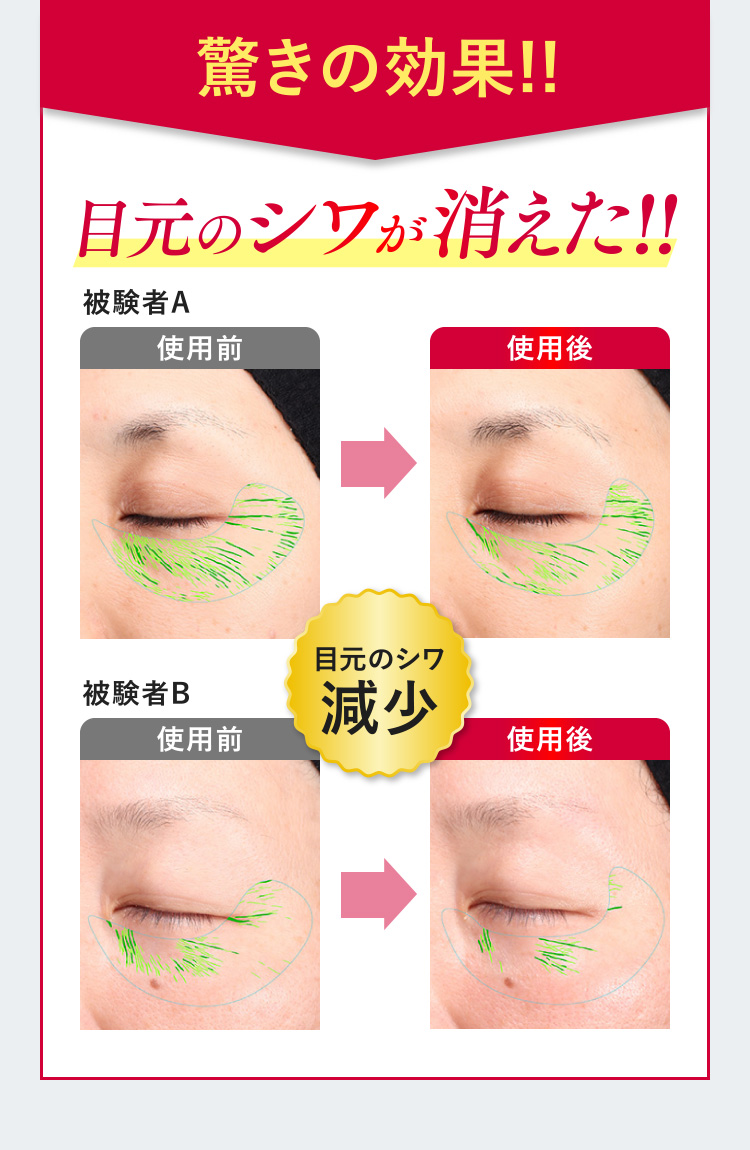 驚きの効果!!目元のシワが消えた!!(被験者A、被験者Bの使用前使用後比較写真)目元のシワ減少