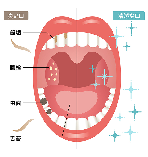 機能1：殺菌 有効成分：セチルピリジニウム塩、化物水和物 口内の殺菌・消毒 口臭を除去！ 機能2：潤い 有効成分：キキョウエキス 唾液の分泌を増やし、口内の乾燥を防ぐ 潤いで菌の増殖を防ぐ