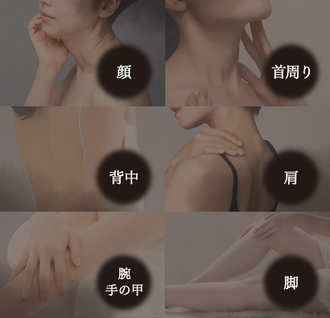 顔、首周り、背中、肩、腕、手の甲、脚